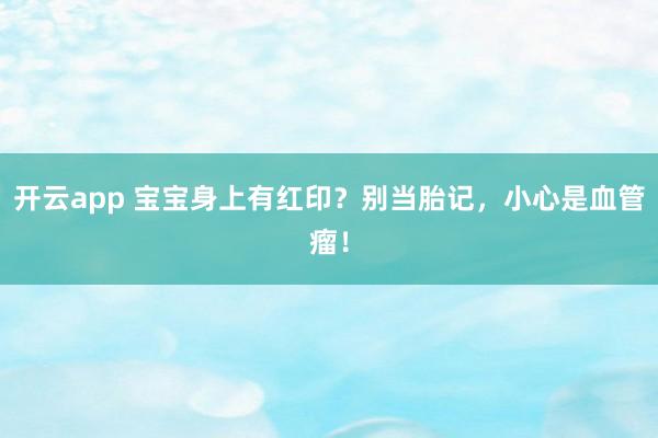 开云app 宝宝身上有红印?别当胎记,小心是血管瘤!